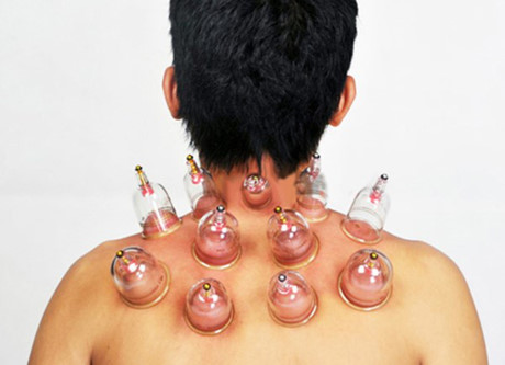 đau lưng mãn tính đau lưng mãn tính